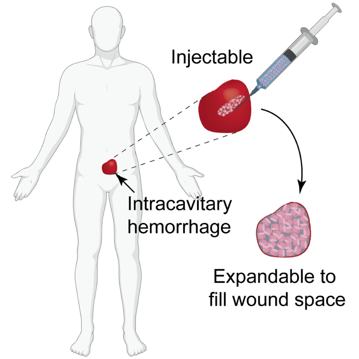 Expandable_Hemostats